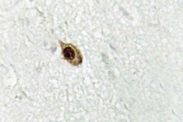 ZIC1+2+3 Antibody (Asp348)