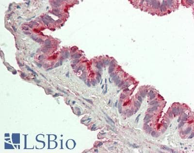 Polyclonal Rabbit anti-Human FOLR1 / Folate Receptor Alpha Antibody (aa25-234, IHC, WB)
