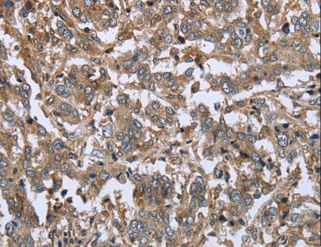 FCAR / CD89 Antibody