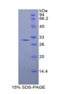 Rat HDAC6 Protein (Recombinant His-T7)