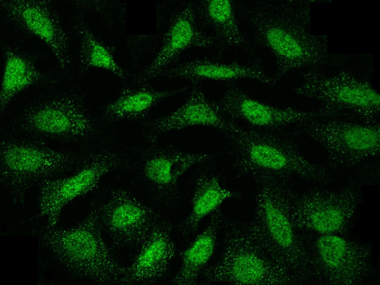 Polyclonal Rabbit anti-Human MAP2K4 / MKK4 Antibody (Preservative Free, IHC, IF)