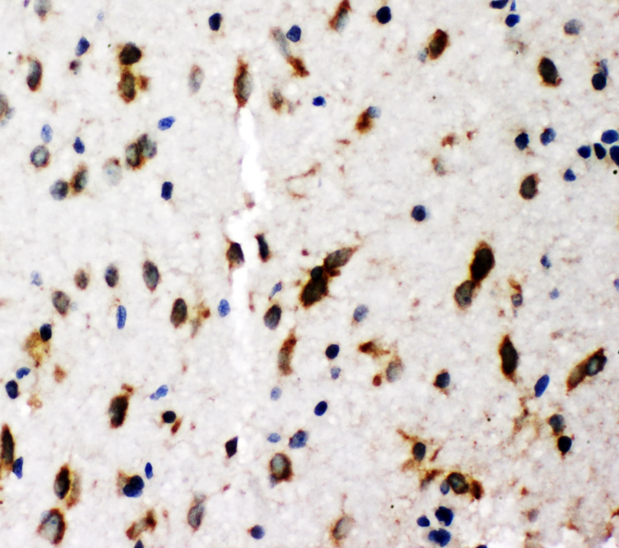 Polyclonal Rabbit anti-Human p66 / SHC Antibody (aa424-440, IHC, WB)