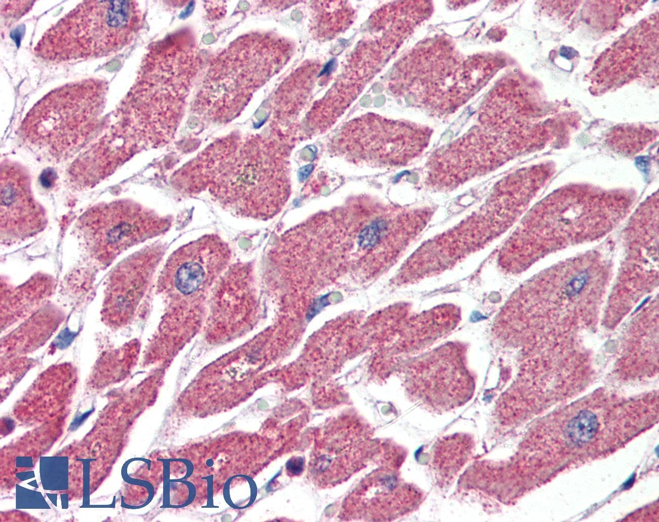 IHC-plus™ Polyclonal Goat anti-Human CPT1A Antibody (aa621-634, IHC, WB)