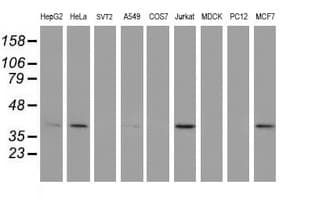 ERCC1 Antibody (clone OTI3B1)