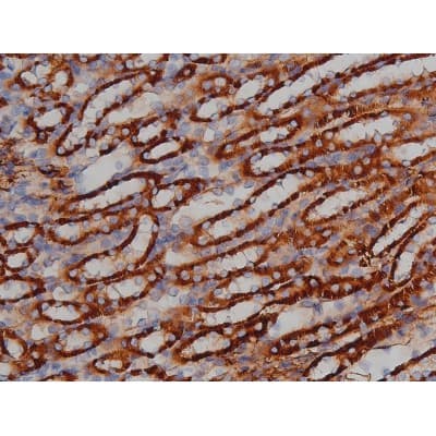 MAPT / Tau Antibody (phospho-Ser422)