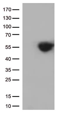 CD274 / B7-H1 / PD-L1 Antibody (clone OTI9A5)