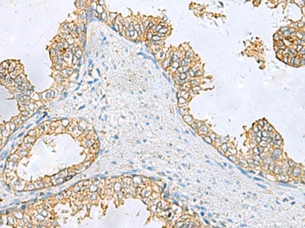 EPCAM Antibody