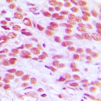 Polyclonal Rabbit anti-Human H2AFX / H2AX Antibody (C-Terminus, IHC, IF, WB)