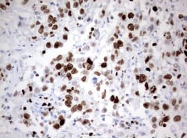 Monoclonal Mouse anti-Human MKI67 / Ki67 Antibody (clone OTI9H1, aa1160-1493, IHC)