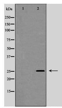 GJB2 / CX26 / Connexin 26 Antibody