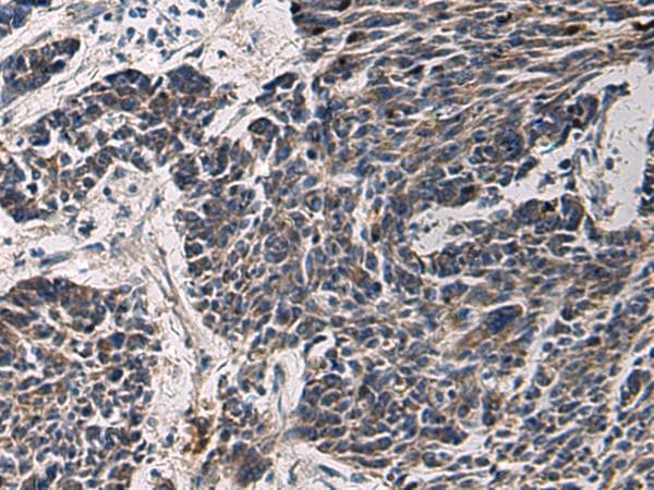 Polyclonal Rabbit anti-Human CCNI / Cyclin I Antibody (IHC)