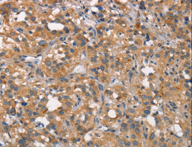 CD66c / CEACAM6 Antibody