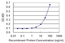 Monoclonal Mouse anti-Human HCCS Antibody (clone 3C7)