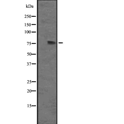 IL12RB2 Antibody