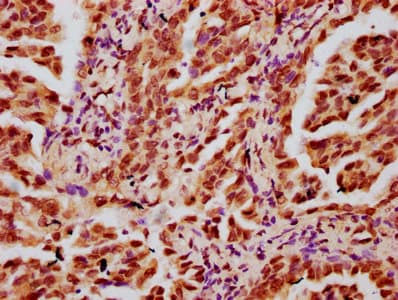 HIST1H3A Antibody