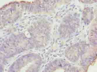 GAJ / MND1 Antibody
