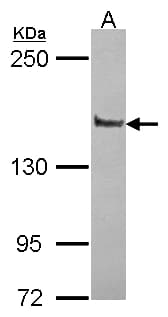 Polyclonal Rabbit anti-Human PPFIA1 / LIPRIN Antibody (aa18-277, WB)