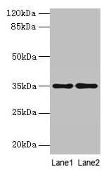 Polyclonal Rabbit anti-Human SDSL / Serine Dehydratase-Like Antibody (IHC, WB)