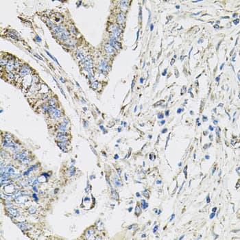 PIK3CB / PI3K Beta Antibody