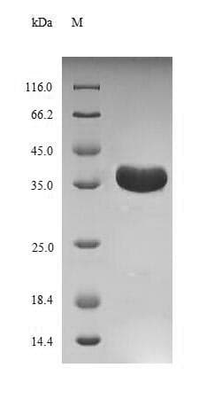 Rotavirus A Rotavirus VP7 Protein (Recombinant 10His, N-terminus + Myc, C-terminus)