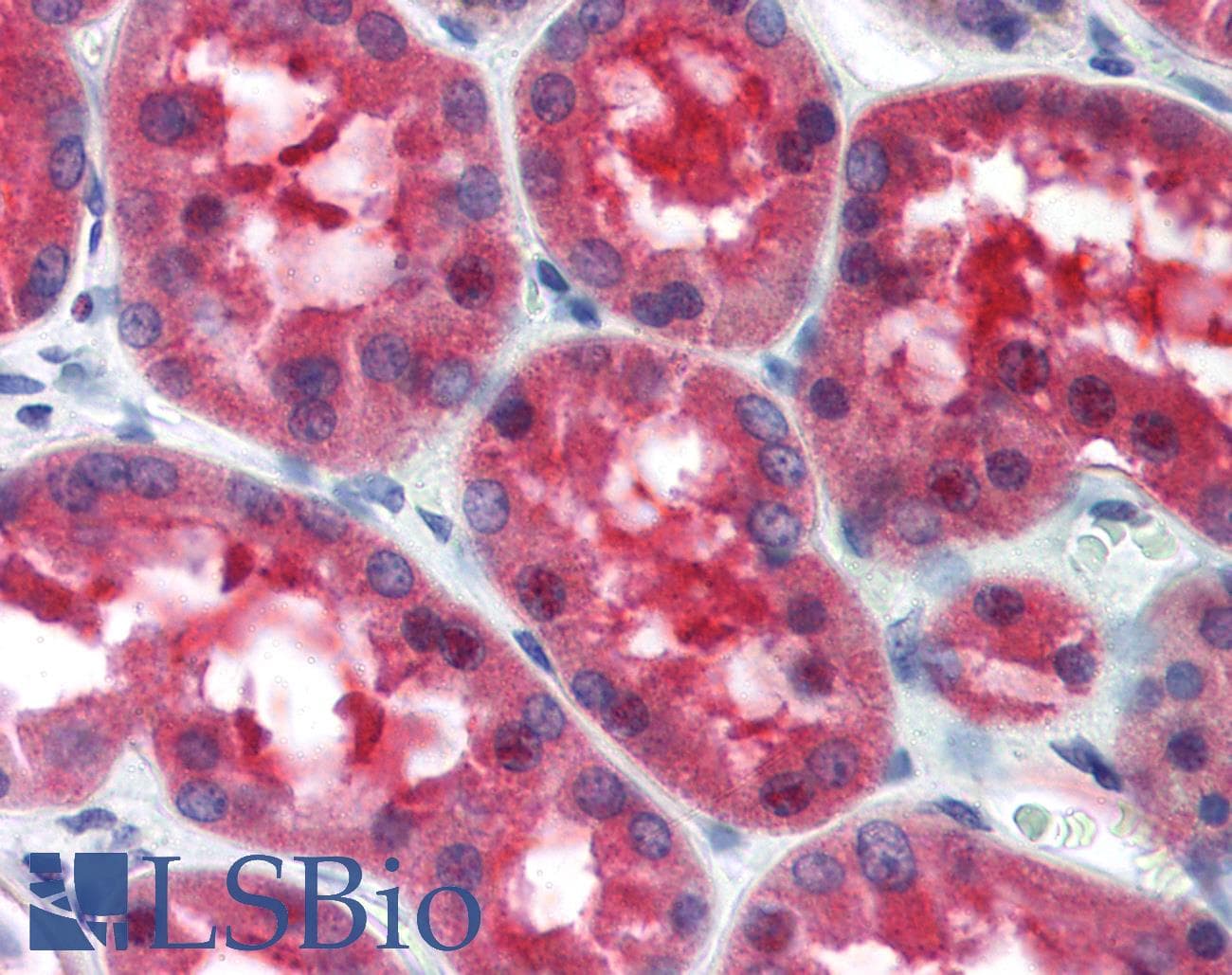IHC-plus™ CRTC1 / MECT1 / TORC1 Antibody