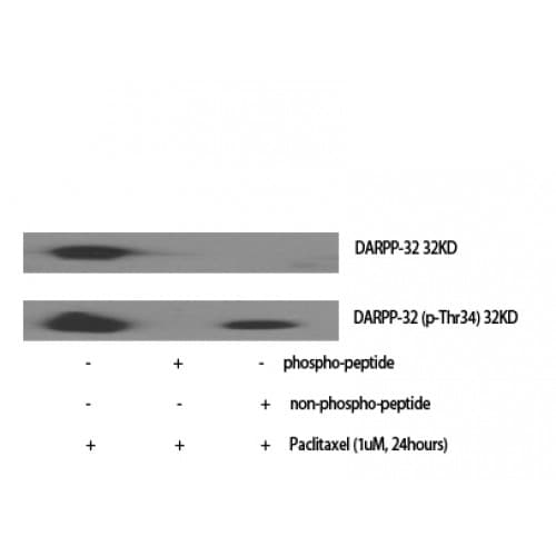 PPP1R1B / DARPP-32 Antibody (10-90 aa)