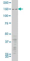 Monoclonal Mouse anti-Human MAP3K5 / ASK1 Antibody (clone 5C4, WB)