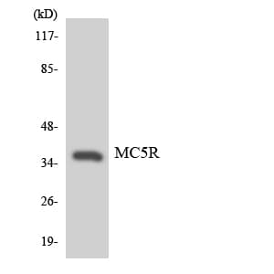 MC5R / MC5 Receptor Antibody (aa259-308)