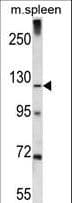 KIAA1324 / maba1 Antibody (aa704-732)
