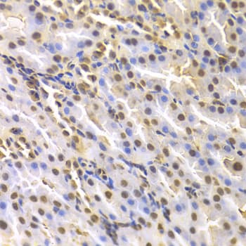 DTNBP1 / Dysbindin Antibody