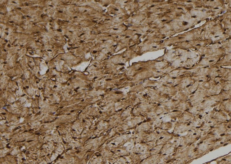 Polyclonal Rabbit anti-Human CYP27C1 Antibody (IHC, WB)
