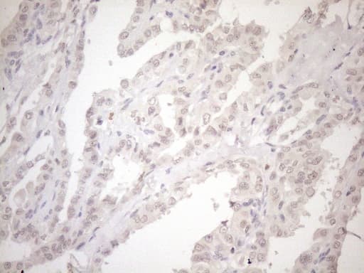 ASB2 Antibody (aa1-300, clone OTI4C2)
