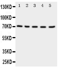 NRG1 / Heregulin / Neuregulin Antibody (aa617-636)