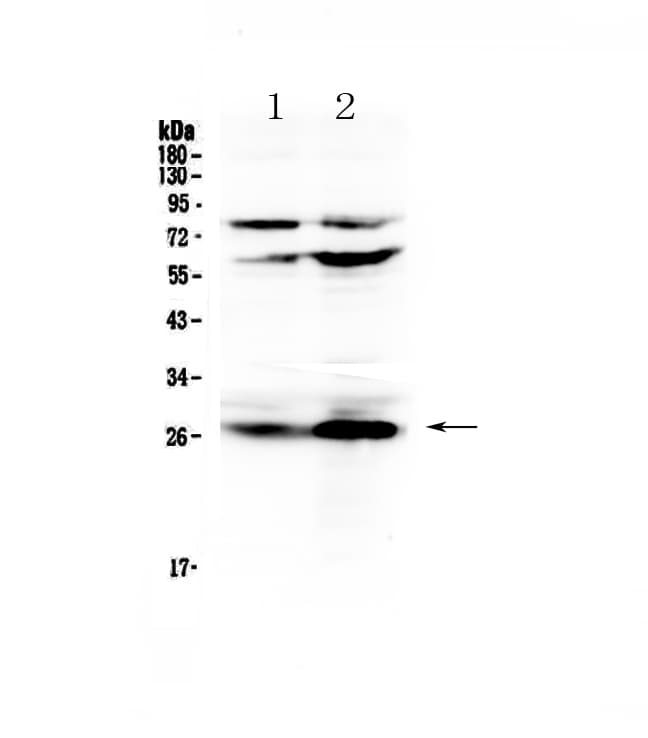 CFD / Factor D / Adipsin Antibody