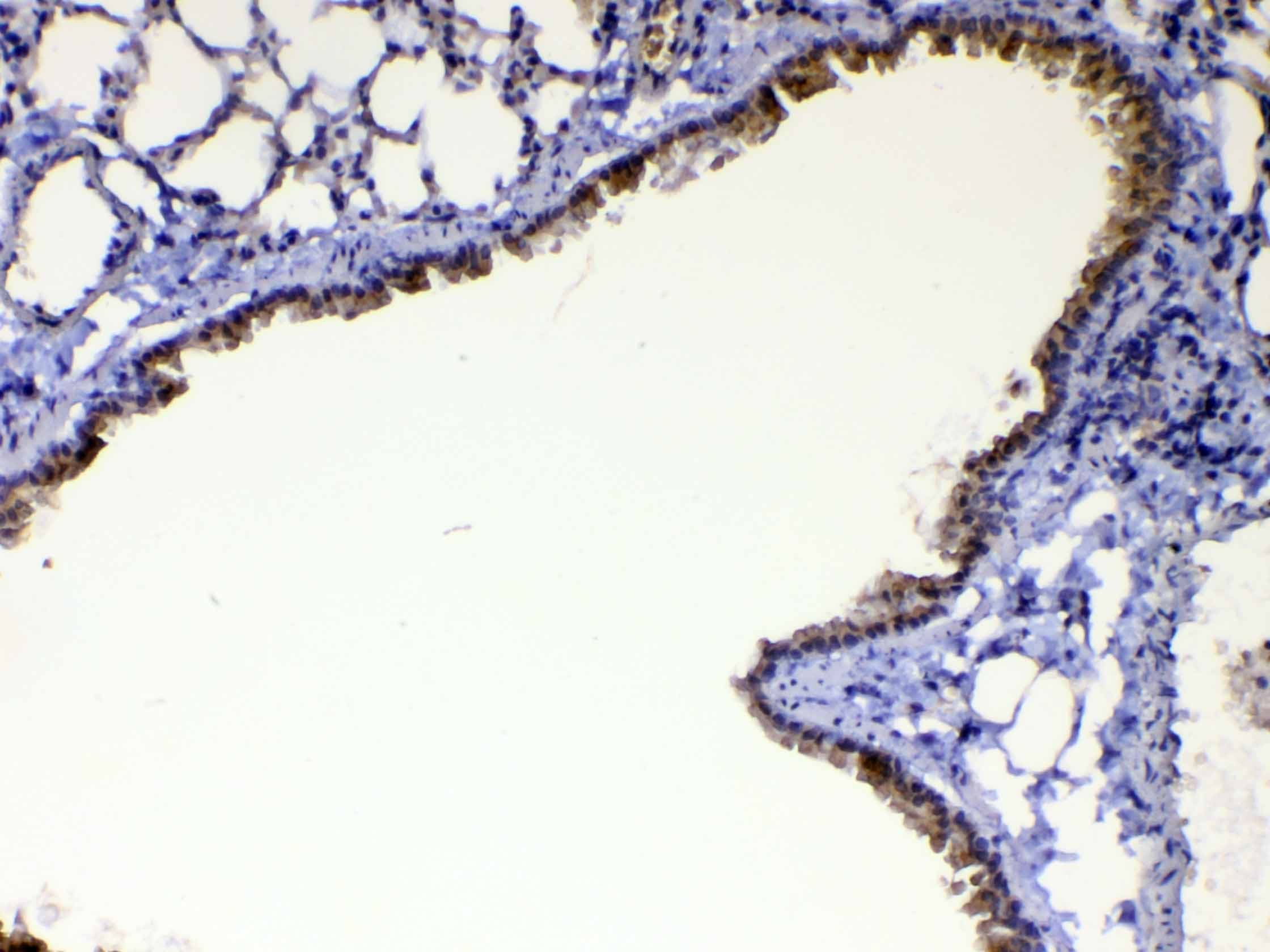 Polyclonal Rabbit anti-Rat WFDC2 / HE4 Antibody (IHC, WB)