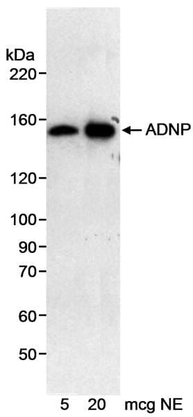 Polyclonal Rabbit anti-Human ADNP Antibody (aa1050-C-term, IHC, WB)