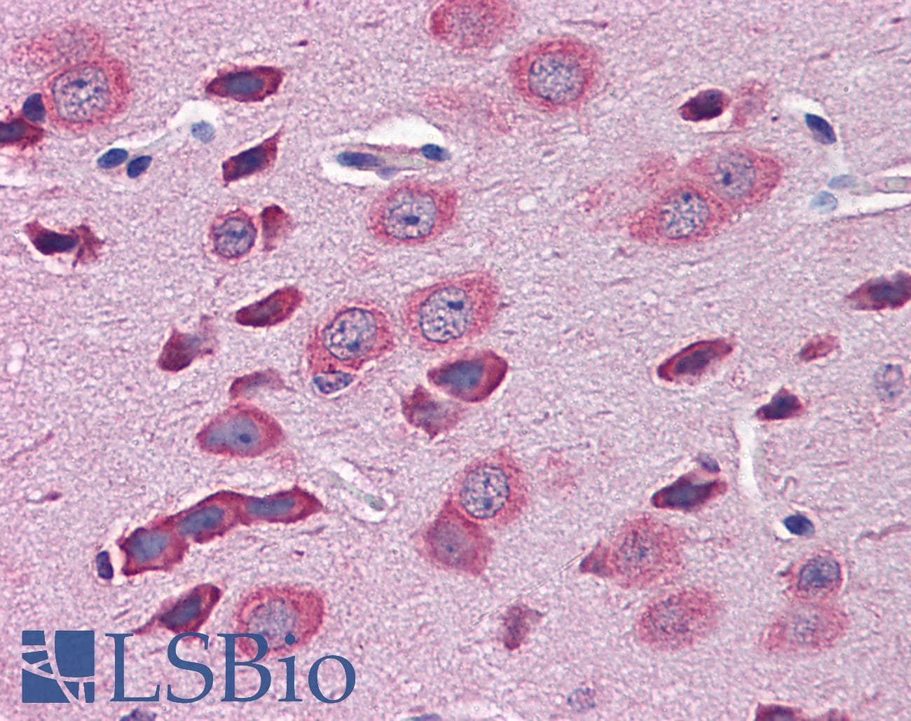 TBR1 Antibody (aa51-100)