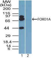 FOXO1 / FKHR Antibody (aa250-300)