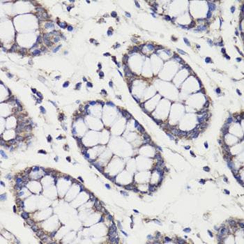 DEPTOR / DEPDC6 Antibody
