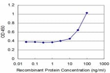 Monoclonal Mouse anti-Human SIX1 Antibody (clone 3C7)