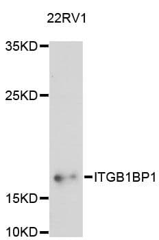 Polyclonal Rabbit anti-Human ITGB1BP1 / ICAP1 Antibody (WB)