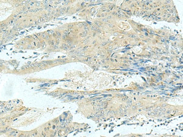 KIF21B Antibody