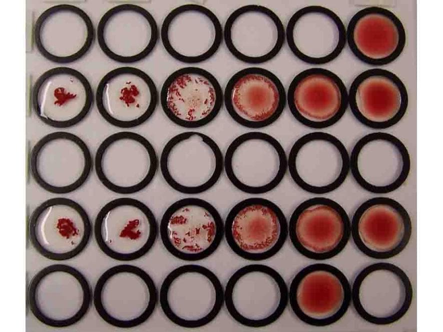 Polyclonal Rabbit anti-Human Erythrocytes Antibody
