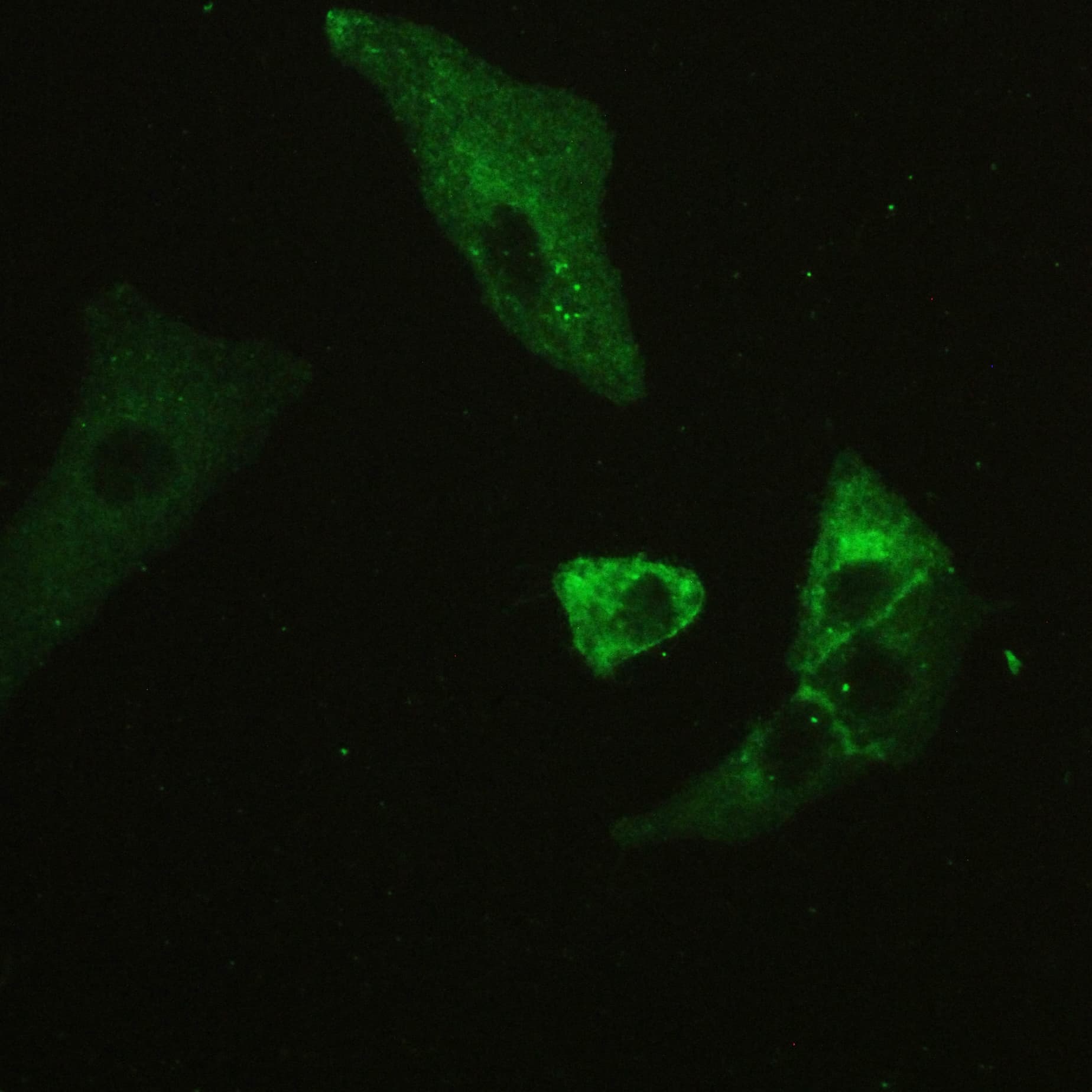 Basigin / Emmprin / CD147 Antibody