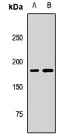 Polyclonal Rabbit anti-Human KIF14 Antibody (WB)
