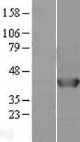 AHSA1 / AHA1 Protein (Over-Expression Lysate Myc-DDK (Flag))