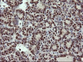 Mannose Phosphate Isomerase Antibody (clone OTI4G7)