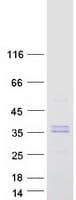 Human CA5A / Carbonic Anhydrase VA Protein (Recombinant Myc-DDK (Flag))