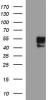 MMP13 Antibody (aa104-471, clone OTI3H3)