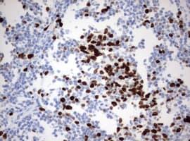 Monoclonal Mouse anti-Human MKI67 / Ki67 Antibody (clone OTI9H1, aa1160-1493, IHC)